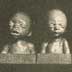 "Comparison of white and negro fetuses" (1)