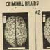 "Massachusetts department of mental diseases exhibits pictures of 59 criminal brains"