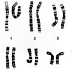Gallery 8: Human female karyotype