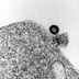 Gallery 25:  Infection of H-9 cells with the MN strain of HIV-1 virus, electromicrograph 3