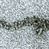 Gallery 29: Electron micrograph of chromatin (1)